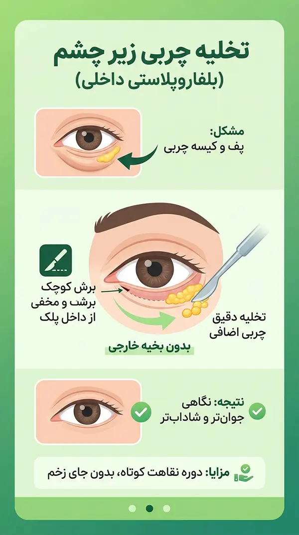 جراحی تخلیه چربی زیر چشم