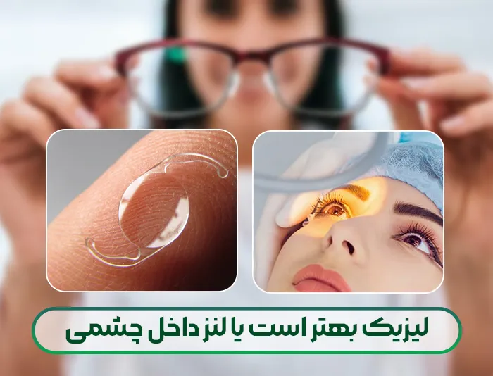 لیزیک بهتر است یا لنز داخل چشمی