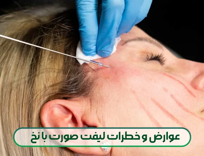 عوارض لیفت صورت با نخ