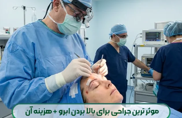 موثر ترین جراحی برای بالا بردن ابرو