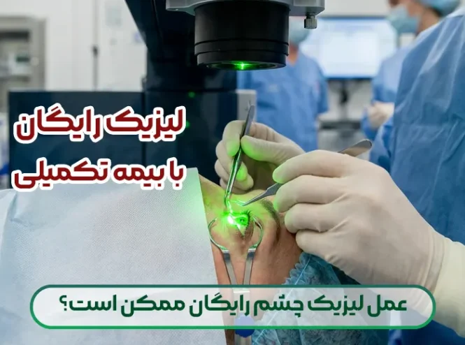 عمل لیزیک چشم رایگان ممکن است؟