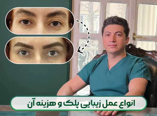انواع عمل زیبایی پلک