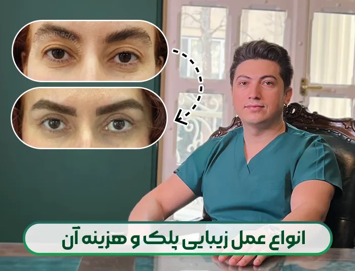 انواع عمل زیبایی پلک
