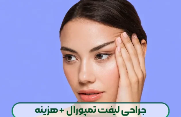 لیفت تمپورال