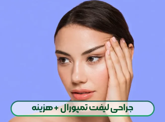 لیفت تمپورال