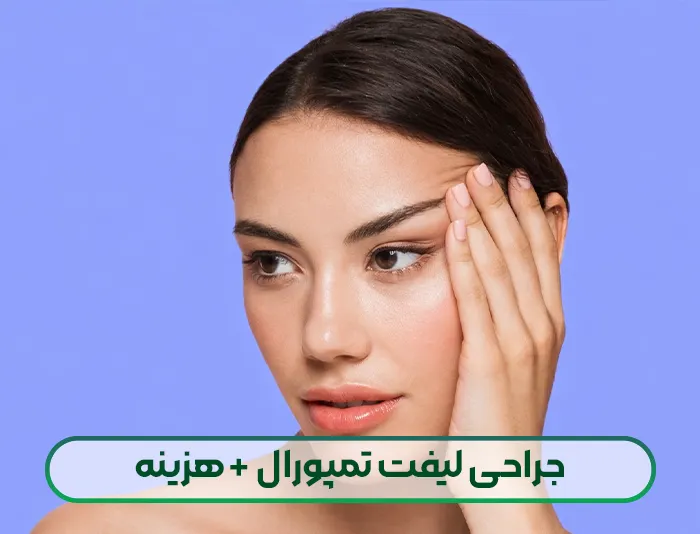 لیفت تمپورال