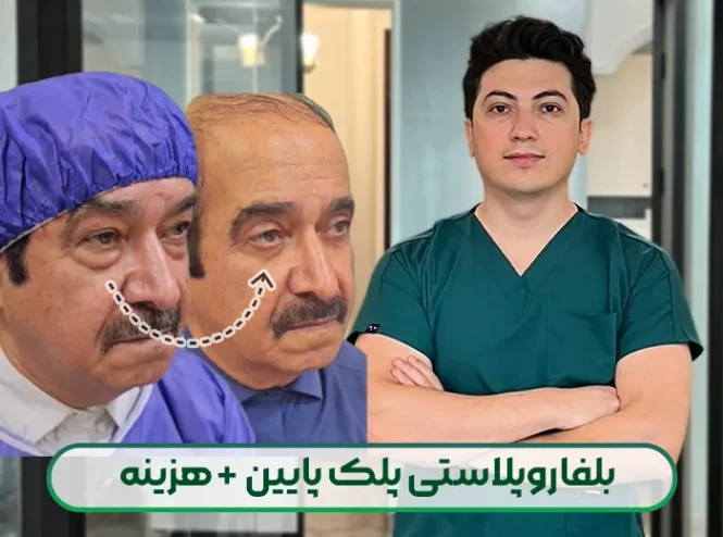 بلفاروپلاستی پلک پایین