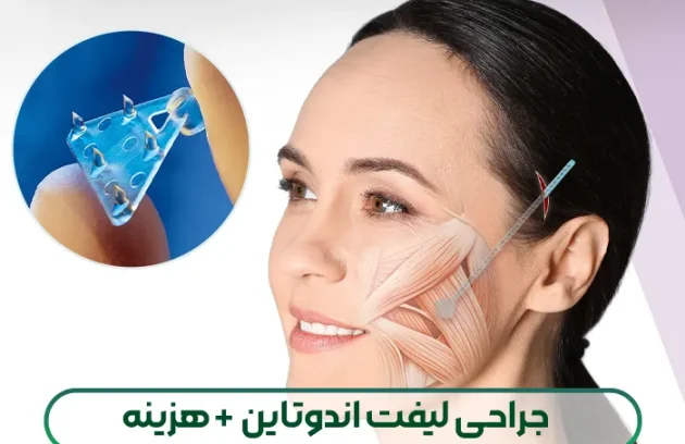 لیفت اندوتاین صورت