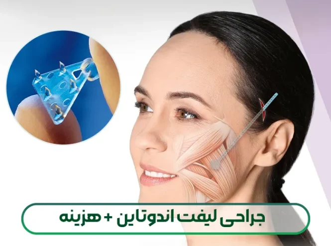 لیفت اندوتاین صورت