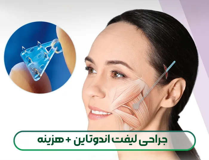 لیفت اندوتاین صورت