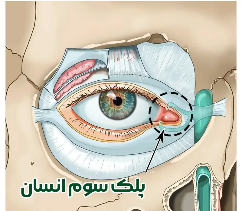 پلک سوم در انسان