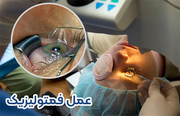 فمتولیزیک