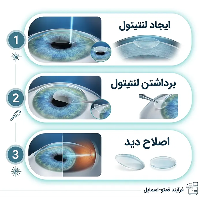 مراحل انجام عمل فمتواسمایل