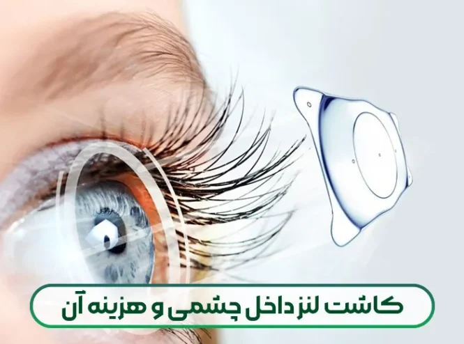 کاشت لنز داخل چشمی و هزینه آن