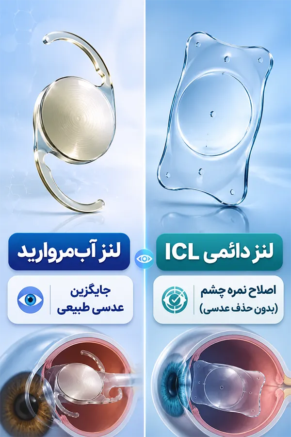 تفاوت لنز های داخل چشمی