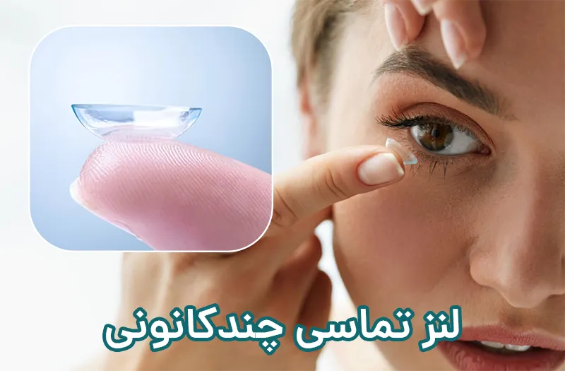 لنز تماسی چندکانونی