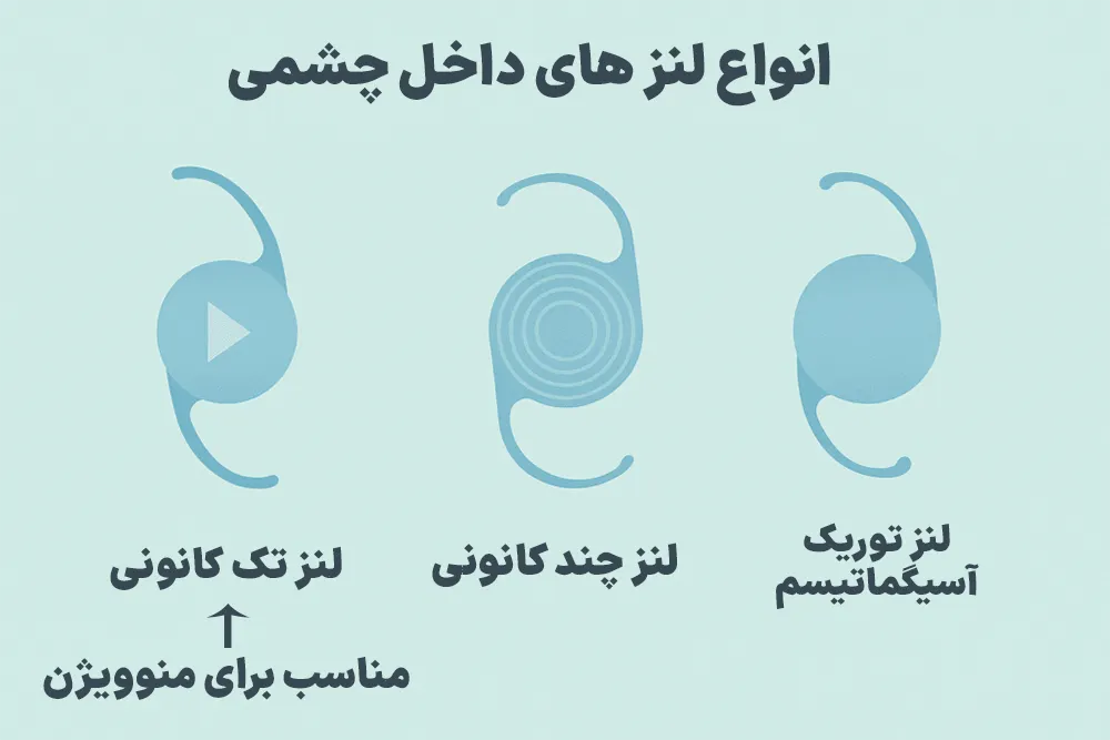 مونوویژن و لنز های چند کانونی