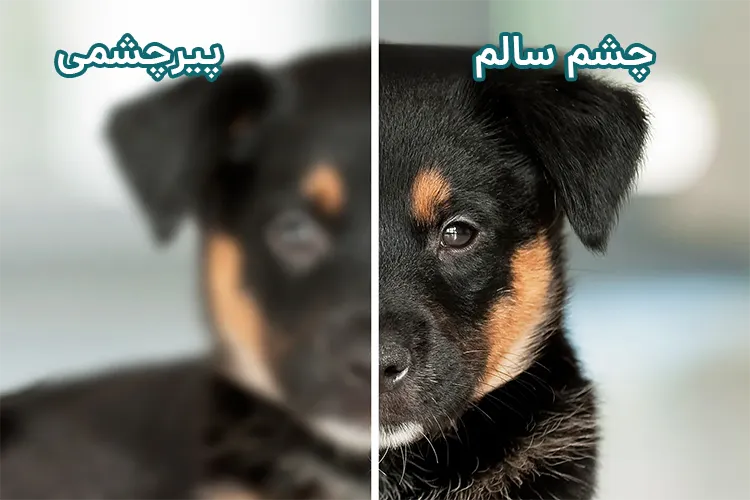 علائم پیرچشمی