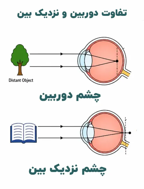 تفاوت نزدیک بینی و دوربینی