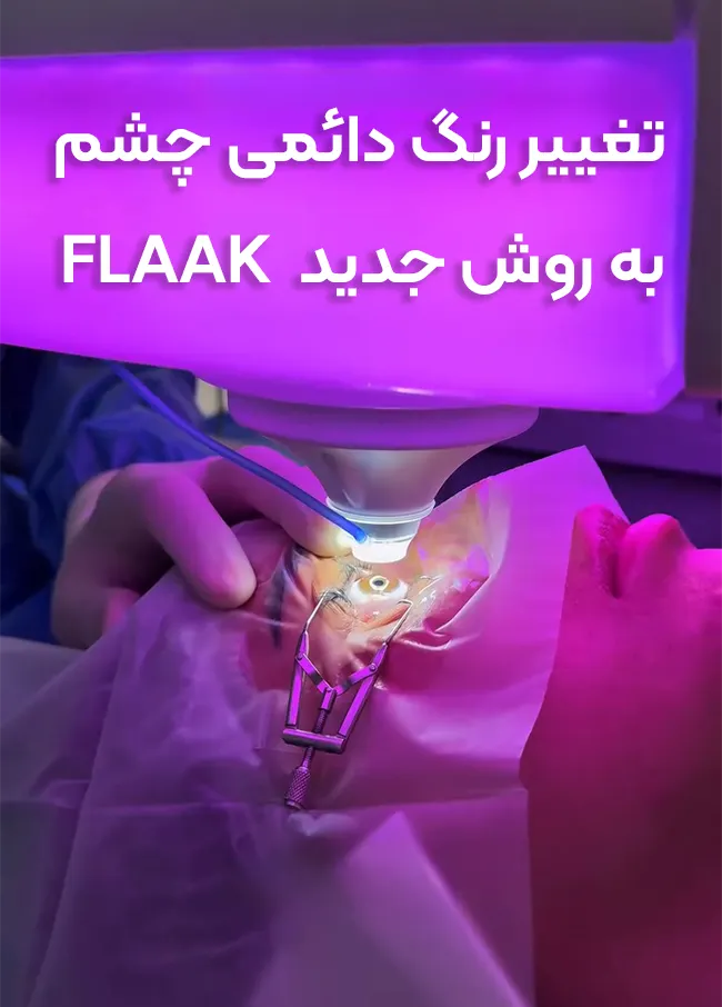 تغییر رنگ چشم FLAAK