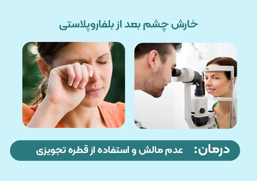 خارش چشم بعد از بلفاروپلاستی
