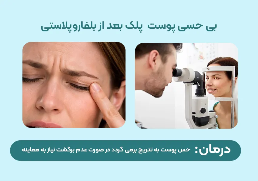 بی حسی یا کاهش حس پوست پلک