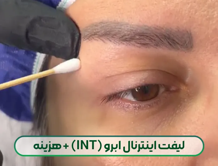 لیفت اینترنال ابرو