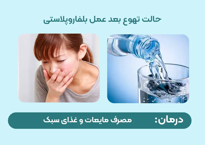حالت تهوع بعد از عمل بلفاروپلاستی