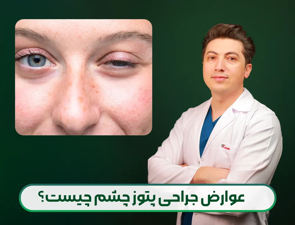 عوارض عمل پتوز چشم