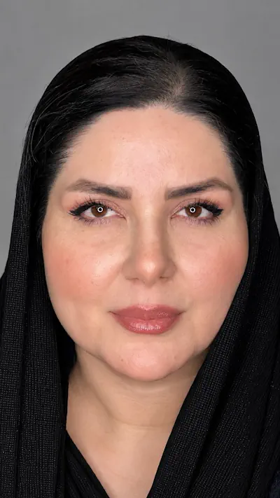نتیجه بلفاروپلاستی پلک بالا